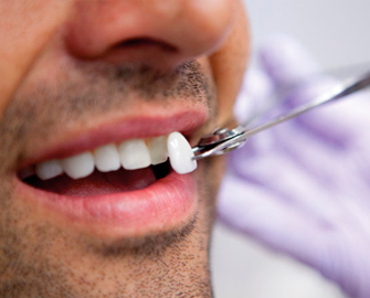 estética dental en Valdemoro