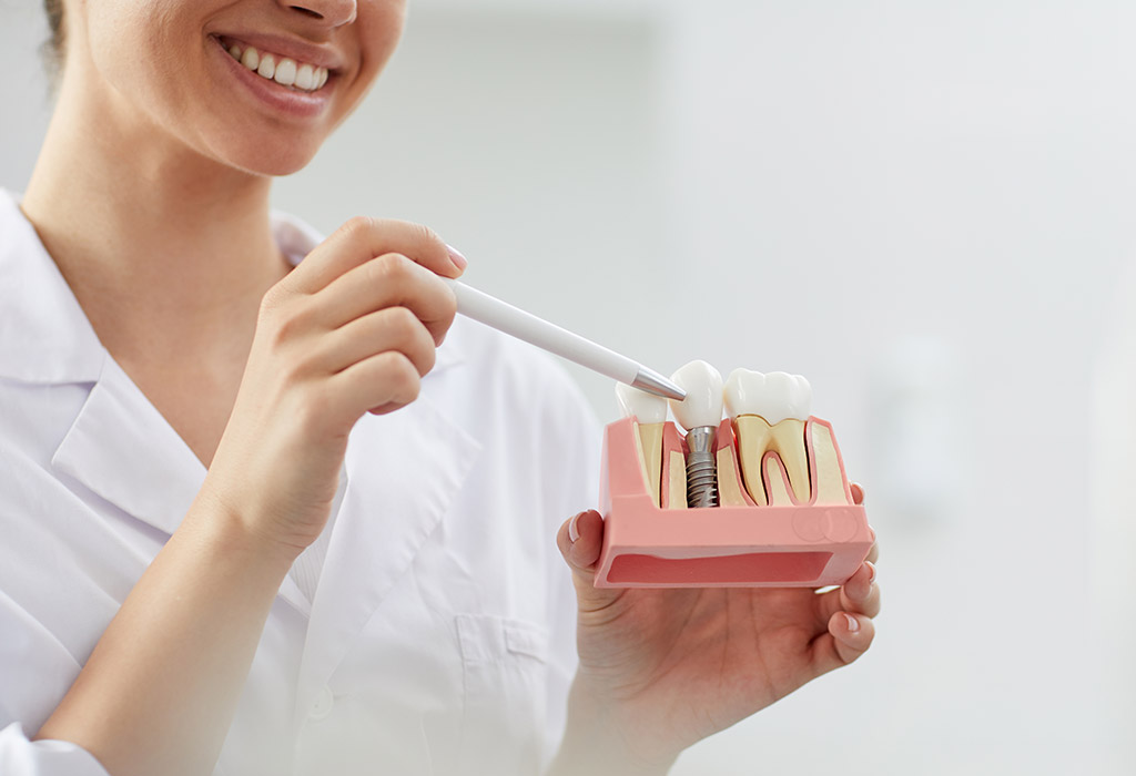 Implantes dentales de carga inmediata en Valdemoro