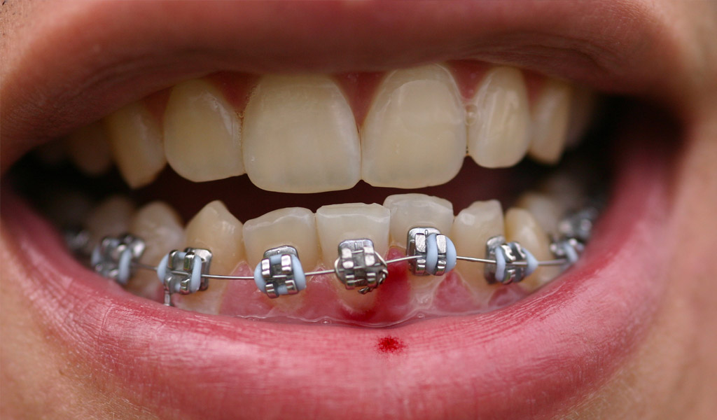 Urgencias dentales en Valdemoro